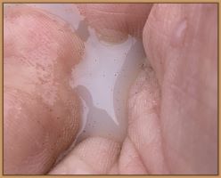 Cloudy milk from a miniature donkey close to foaling.